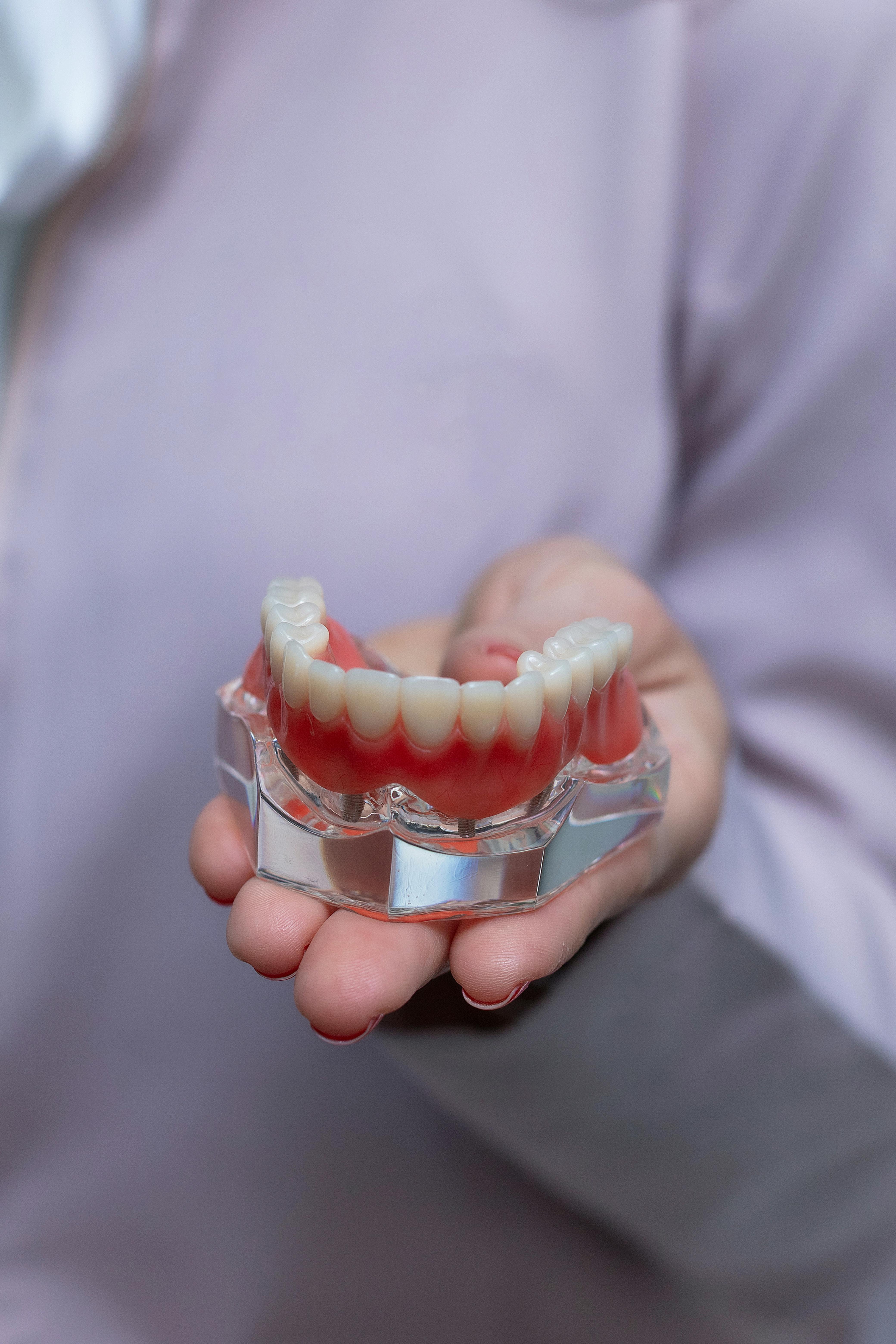 All-on-4 dental implants at Kanaka Creek Family Dental in Maple Ridge