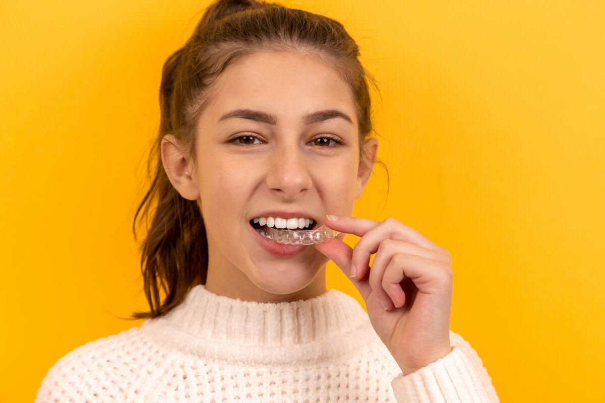 MARPE palatal expansion at Kanaka Creek Family Dental in Maple Ridge