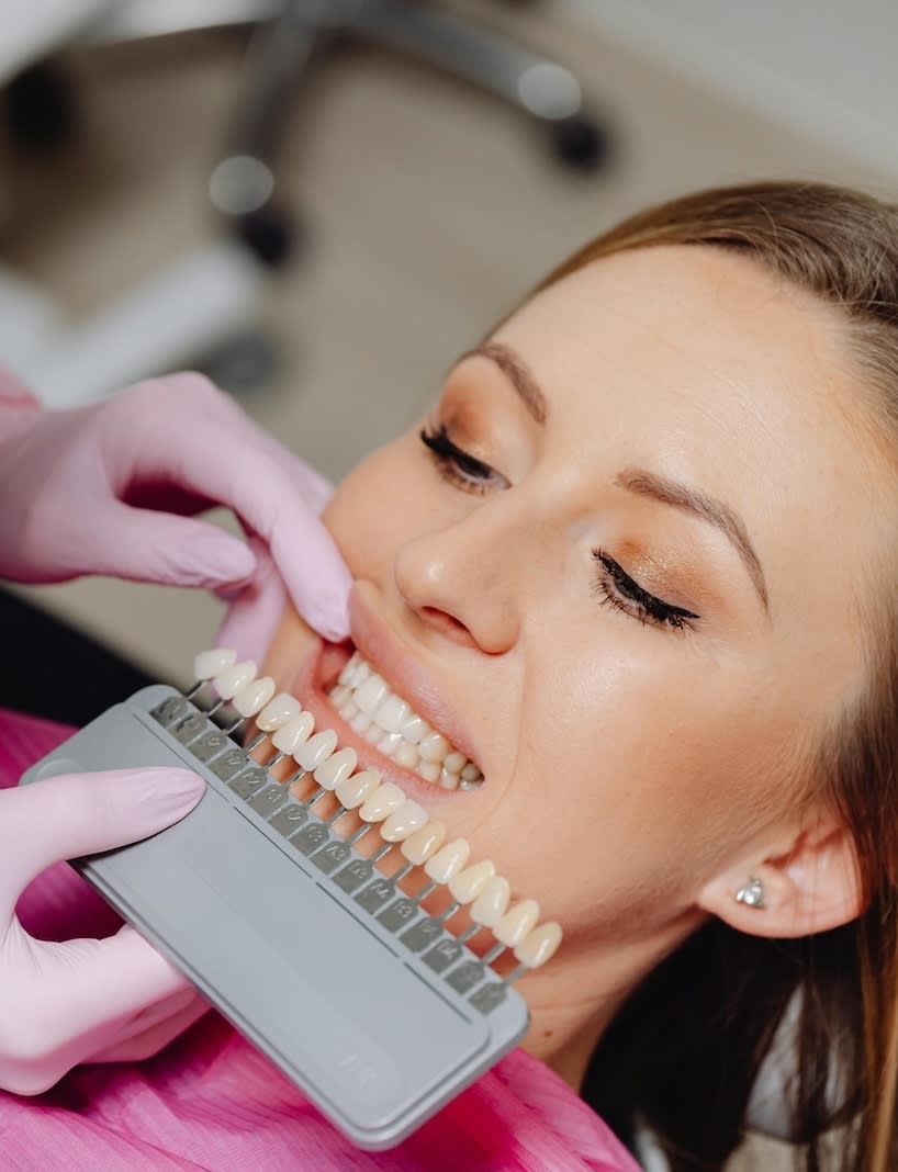 Professional teeth whitening at Kanaka Creek Family Dental in Maple Ridge
